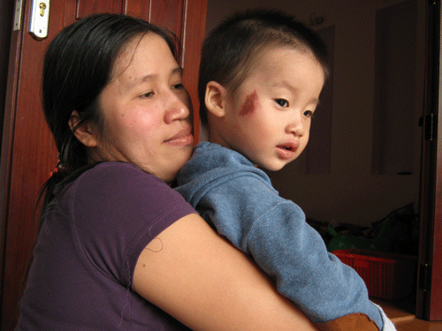 Bé 19 tháng tuổi bị cô giáo đánh